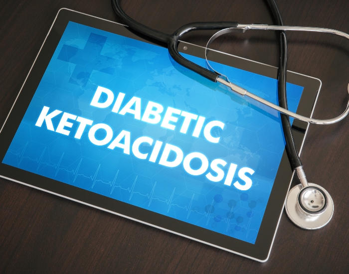 Diabetic Ketoacidosis Treatment and Emergency Care