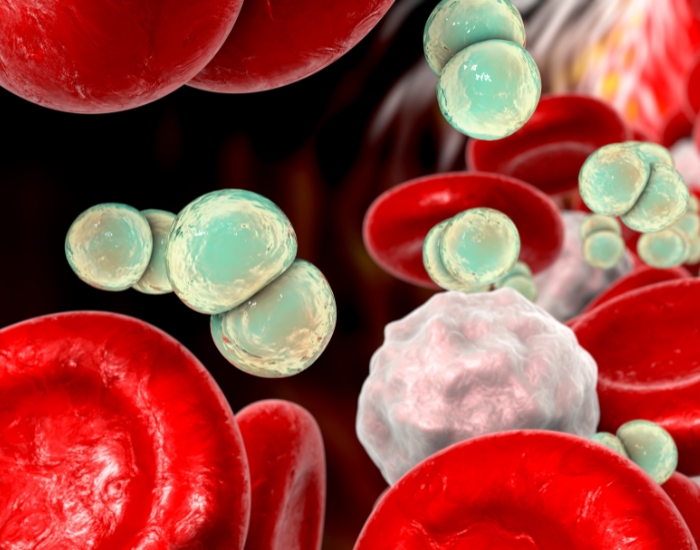 can an infection cause sepsis