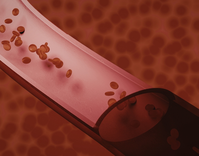 is blood clot dangerous