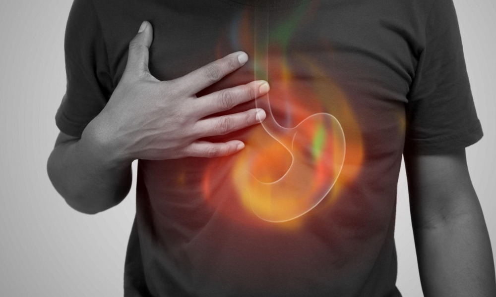 Heartburn chest pain after meals caused by acid reflux and GERD