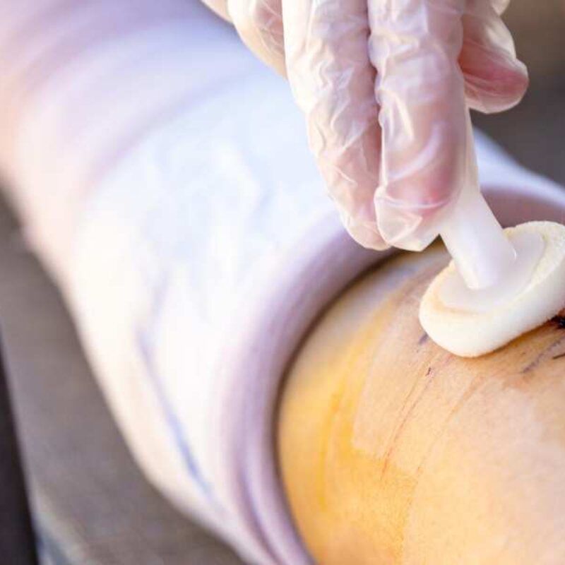 Wound care and stitches at The Heights Emergency Room in Houston