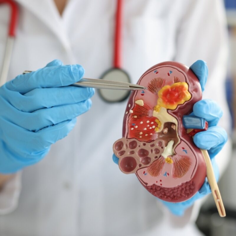 Kidney stone and flank pain evaluation at The Heights Emergency Room in Houston